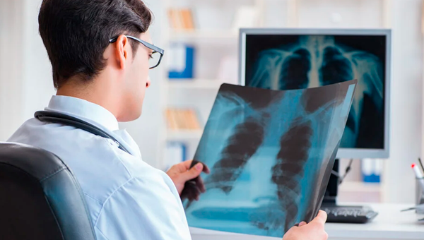 Цифровая рентгенография