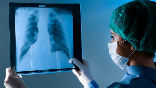 Рентгенография: классика визуализации (легкие, кости)